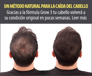 profolan 300x250 2 ES 1